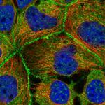 PACSIN2 Antibody in Immunocytochemistry (ICC/IF)