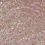 PACSIN2 Antibody in Immunohistochemistry (Paraffin) (IHC (P))