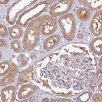 PACSIN2 Antibody in Immunohistochemistry (Paraffin) (IHC (P))