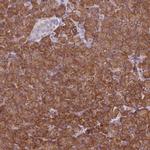 PACSIN2 Antibody in Immunohistochemistry (Paraffin) (IHC (P))