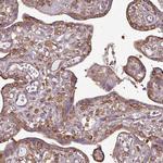 PACSIN2 Antibody in Immunohistochemistry (Paraffin) (IHC (P))