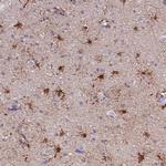 PFKFB2 Antibody in Immunohistochemistry (Paraffin) (IHC (P))