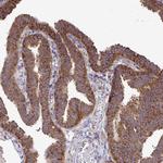 FMRP Antibody in Immunohistochemistry (Paraffin) (IHC (P))