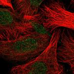 Dectin 1 (soluble) Antibody in Immunocytochemistry (ICC/IF)