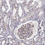 RPP38 Antibody in Immunohistochemistry (Paraffin) (IHC (P))