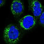 HSDL2 Antibody in Immunocytochemistry (ICC/IF)