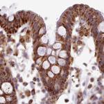 HSDL2 Antibody in Immunohistochemistry (Paraffin) (IHC (P))