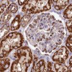 HSDL2 Antibody in Immunohistochemistry (Paraffin) (IHC (P))