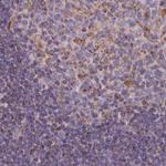 HSDL2 Antibody in Immunohistochemistry (Paraffin) (IHC (P))