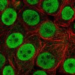 FOXA1 Antibody in Immunocytochemistry (ICC/IF)