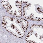 FOXA1 Antibody in Immunohistochemistry (Paraffin) (IHC (P))