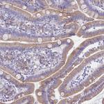 TMP21 Antibody in Immunohistochemistry (Paraffin) (IHC (P))