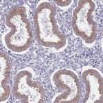 TMP21 Antibody in Immunohistochemistry (Paraffin) (IHC (P))