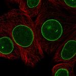 LAP1 Antibody in Immunocytochemistry (ICC/IF)