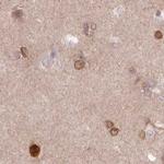 LAP1 Antibody in Immunohistochemistry (Paraffin) (IHC (P))