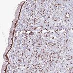 LAP1 Antibody in Immunohistochemistry (Paraffin) (IHC (P))