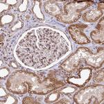 LAP1 Antibody in Immunohistochemistry (Paraffin) (IHC (P))