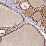 LAP1 Antibody in Immunohistochemistry (Paraffin) (IHC (P))