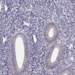 PBK Antibody in Immunohistochemistry (Paraffin) (IHC (P))