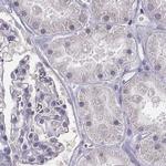 PBK Antibody in Immunohistochemistry (Paraffin) (IHC (P))