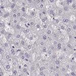 PBK Antibody in Immunohistochemistry (Paraffin) (IHC (P))