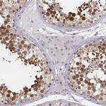 PBK Antibody in Immunohistochemistry (Paraffin) (IHC (P))