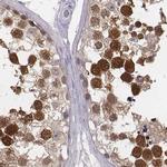 PBK Antibody in Immunohistochemistry (Paraffin) (IHC (P))