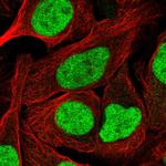 NFYA Antibody in Immunocytochemistry (ICC/IF)