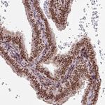 NFYA Antibody in Immunohistochemistry (Paraffin) (IHC (P))