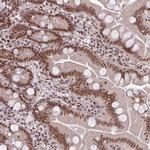 NFYA Antibody in Immunohistochemistry (Paraffin) (IHC (P))