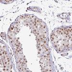 NFYA Antibody in Immunohistochemistry (Paraffin) (IHC (P))