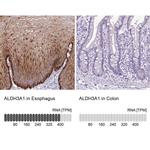 ALDH3A1 Antibody