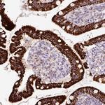 PCK2 Antibody in Immunohistochemistry (Paraffin) (IHC (P))