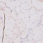 PCK2 Antibody in Immunohistochemistry (Paraffin) (IHC (P))