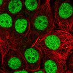 TRBP Antibody in Immunocytochemistry (ICC/IF)