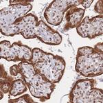 TRBP Antibody in Immunohistochemistry (Paraffin) (IHC (P))