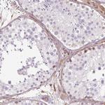 Calponin 3 Antibody in Immunohistochemistry (Paraffin) (IHC (P))