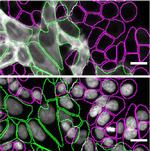 Calponin 3 Antibody in Immunocytochemistry (ICC/IF)