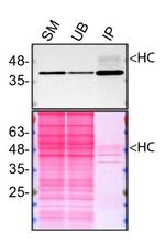 Calponin 3 Antibody in Western Blot (WB)