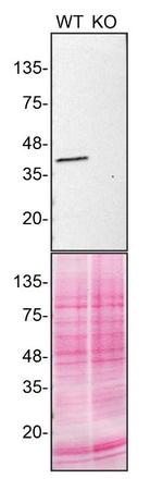 Calponin 3 Antibody in Western Blot (WB)