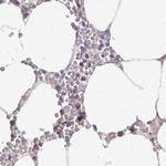 Catalase Antibody in Immunohistochemistry (Paraffin) (IHC (P))