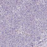 Catalase Antibody in Immunohistochemistry (Paraffin) (IHC (P))