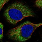 eIF4E Antibody in Immunocytochemistry (ICC/IF)