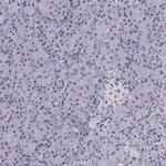 INCENP Antibody in Immunohistochemistry (Paraffin) (IHC (P))