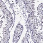 INCENP Antibody in Immunohistochemistry (Paraffin) (IHC (P))