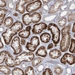 DISP1 Antibody in Immunohistochemistry (Paraffin) (IHC (P))