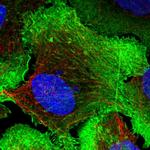 Drebrin Antibody in Immunocytochemistry (ICC/IF)