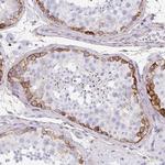 Drebrin Antibody in Immunohistochemistry (Paraffin) (IHC (P))