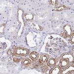 Drebrin Antibody in Immunohistochemistry (Paraffin) (IHC (P))