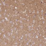 Drebrin Antibody in Immunohistochemistry (Paraffin) (IHC (P))